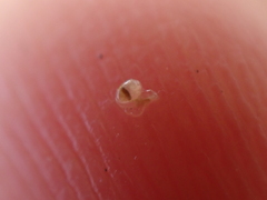 Entoprocta