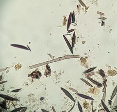 Rosellinia