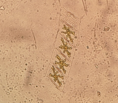 Mediopyxis helysia