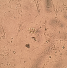 Asterionellopsis glacialis