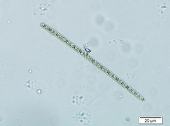 Planktothrix