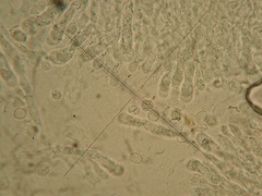 Radulomyces confluens