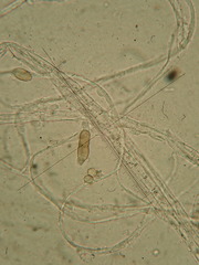 Microdochium nivale