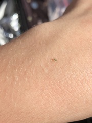 Aphididae