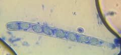 Scutellinia olivascens