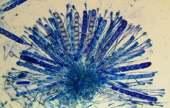 Scutellinia olivascens