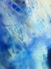 Scutellinia olivascens