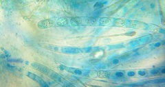 Scutellinia olivascens