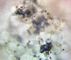 Coprinellus saccharinus