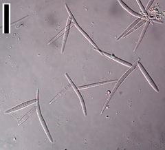 Tricladium splendens