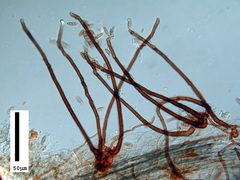 Ramichloridium carlinae