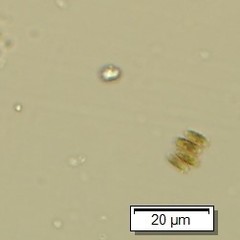 Scenedesmus ellipticus