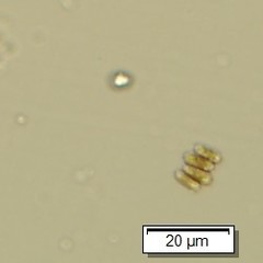 Scenedesmus ellipticus