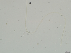 Ulothrix