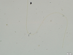 Ulothrix