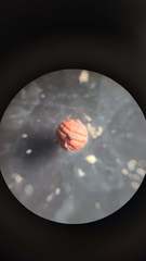 Callirhytis gemmiformis