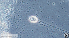 Pseudovorticella