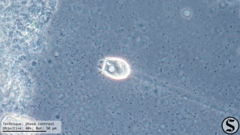 Pseudovorticella