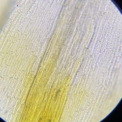 Racomitrium aquaticum