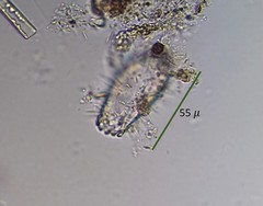 Euglypha strigosa