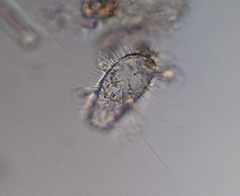 Euglypha strigosa