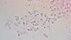 Pseudoomphalina intermedia