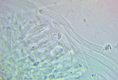 Pseudoomphalina intermedia