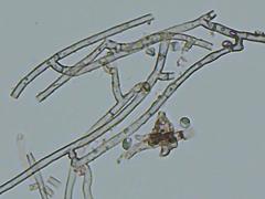 Byssocorticium pulchrum