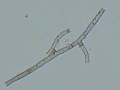 Byssocorticium pulchrum