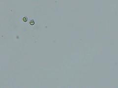 Byssocorticium pulchrum