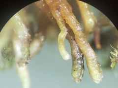 Bryochiton microscopicus