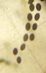 Anthostomella conorum