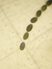 Anthostomella conorum