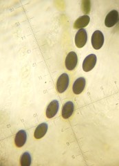 Anthostomella conorum