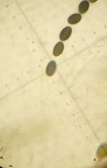 Anthostomella conorum