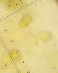 Pestalotiopsis funerea