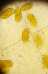 Cucurbitaria berberidis