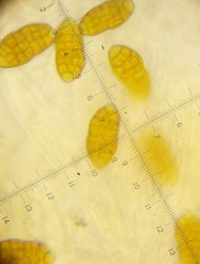 Cucurbitaria berberidis