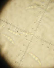 Lophiostoma angustilabrum
