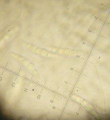 Lophiostoma angustilabrum