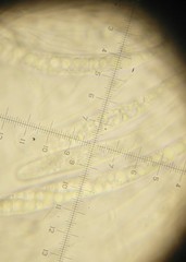 Lophiostoma angustilabrum