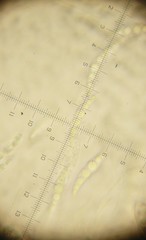 Lophiostoma angustilabrum