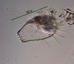 Euglypha acanthophora