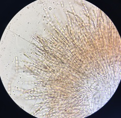 Phomatospora coprophila