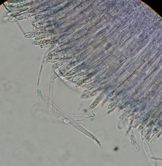Ciborinia camelliae
