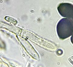 Coprinopsis mitrispora