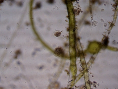 Vorticella campanula