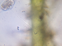 Vorticella campanula