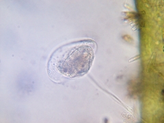 Vorticella campanula