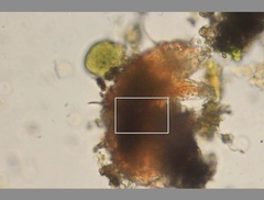 Echiniscidae